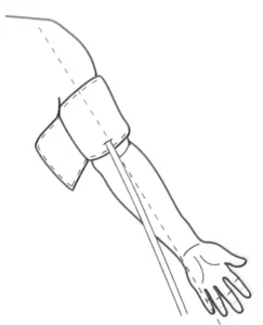 For a meaningful comparison, try to measure under similar conditions. For example, take daily measurements at approximately the same time, on the same arm, or as directed by a physician.