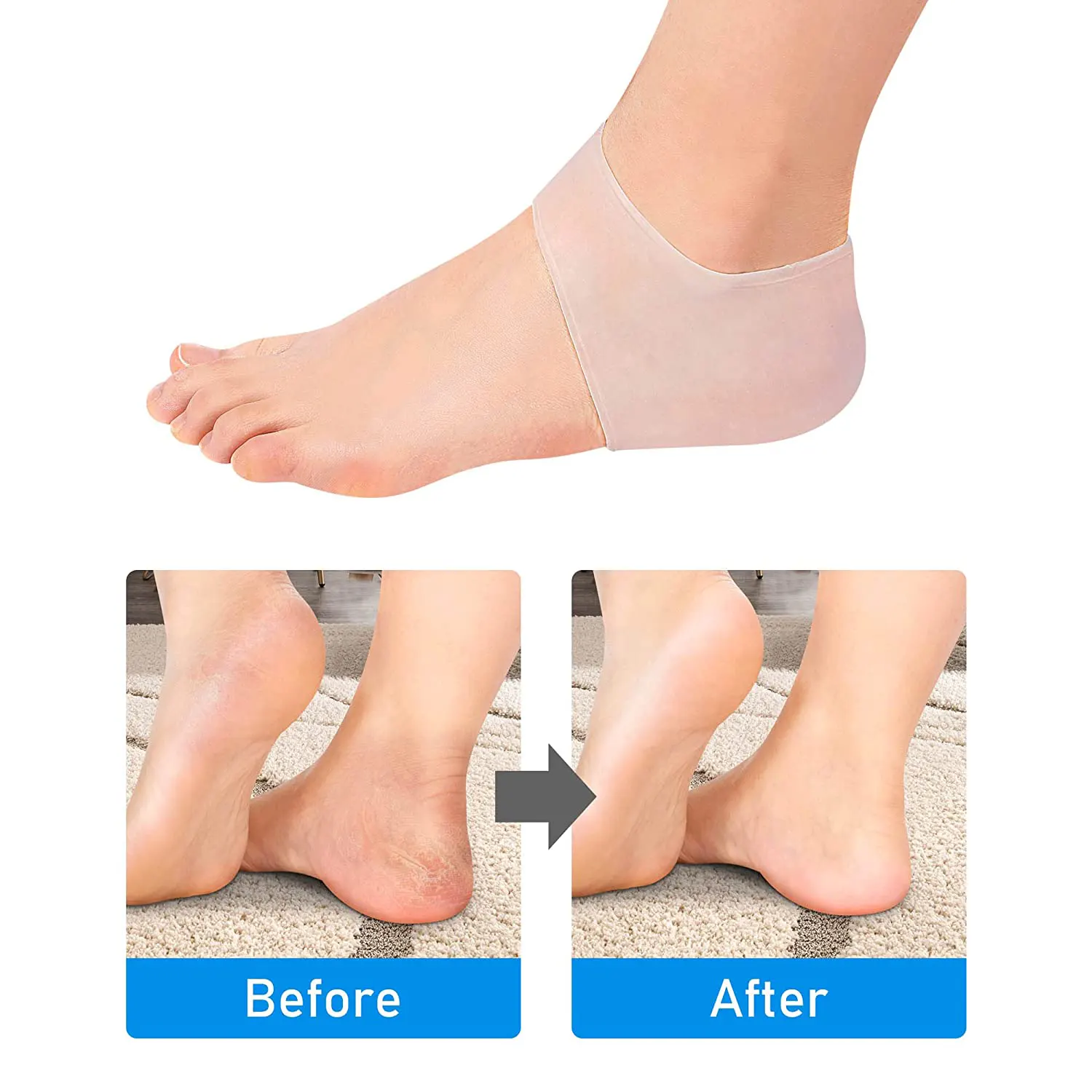 Silicone heel cover Mediplus usage before and after